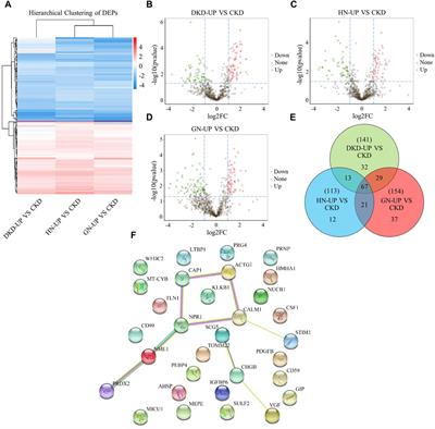 Data independent acquisition reveals in-depth serum proteome changes in uremic pruritus